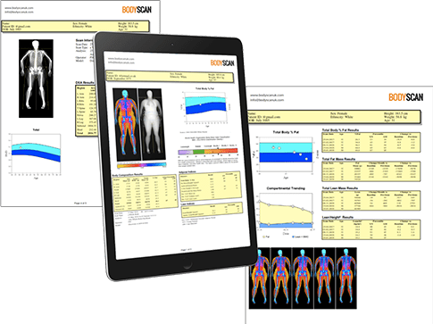 Private Dexa Scan Body Fat Measurement Bodyscan Uk