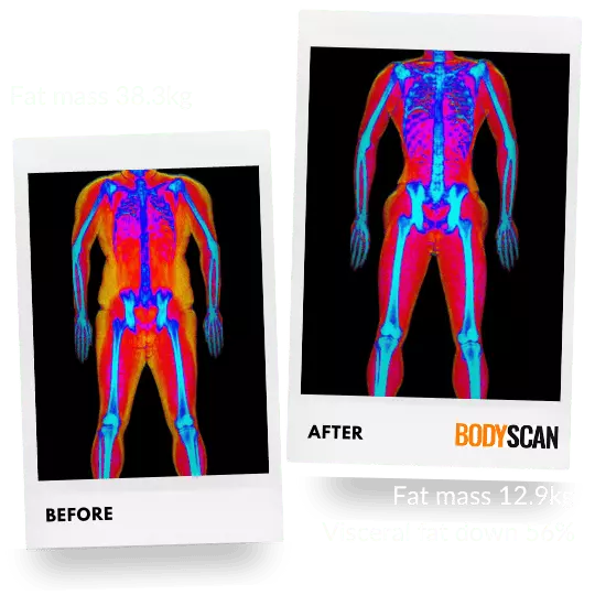 Jinal's before and after weight loss dexa scan images