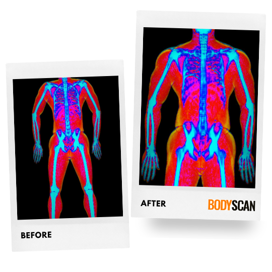 Nathan's before and after weight loss dexa scan images