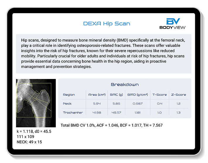 An example of our RMR test results