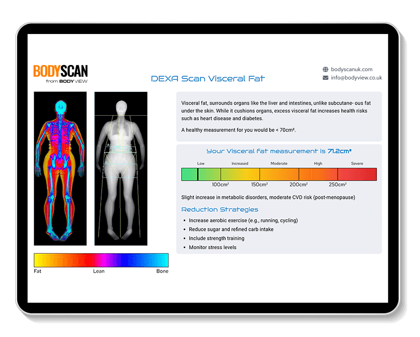 An example of our RMR test results