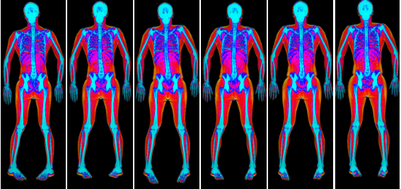 DEXA scan body image
