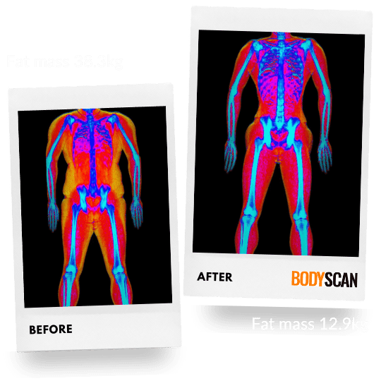 DEXA images showing fat loss