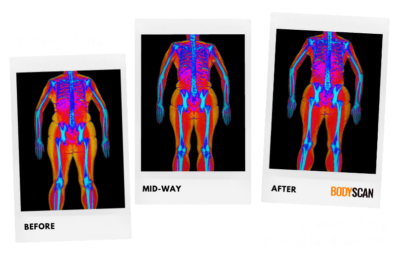 Fat loss DEXA scan images Julie