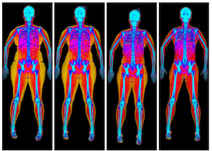 DEXA scan images showing fat loss