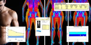 What does a DEXA scan tell me?