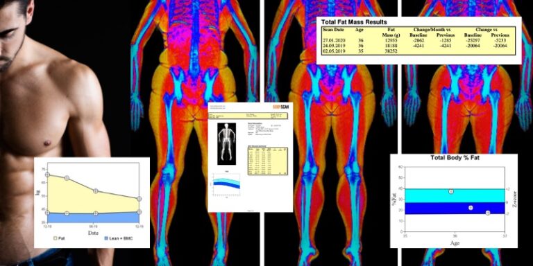 what-does-a-dexa-scan-show-me-bodyscan-uk