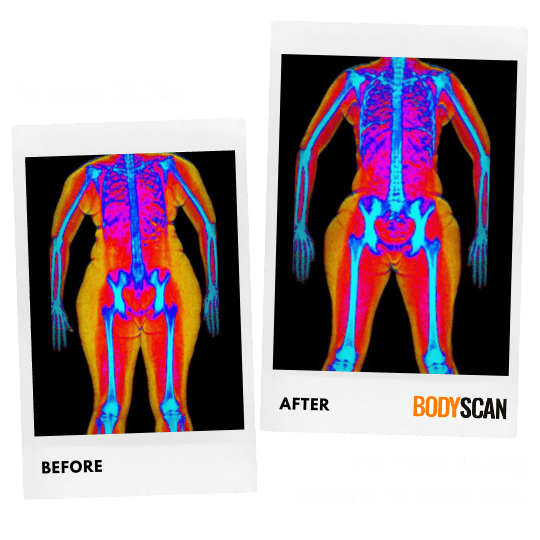 Dexa Scan In London Dexa Scan Uk Bodyscan 5713