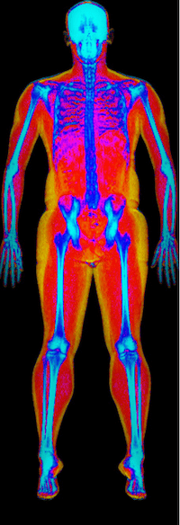Male DEXA scan image