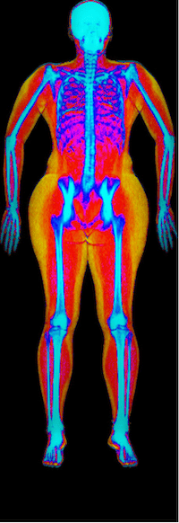 Female DEXA scan image