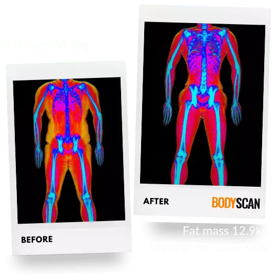 Jinal DEXA scan images for fat loss