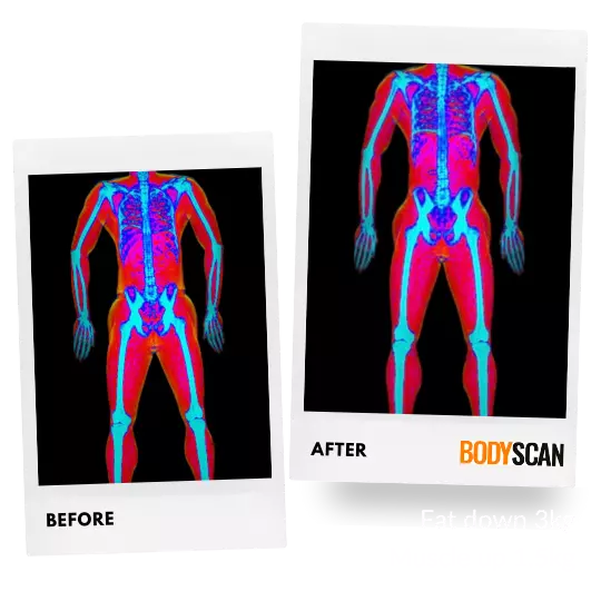 Nathan's DEXA scan images