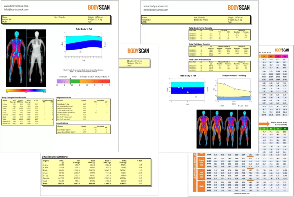 Bodyscan DEXA scan report