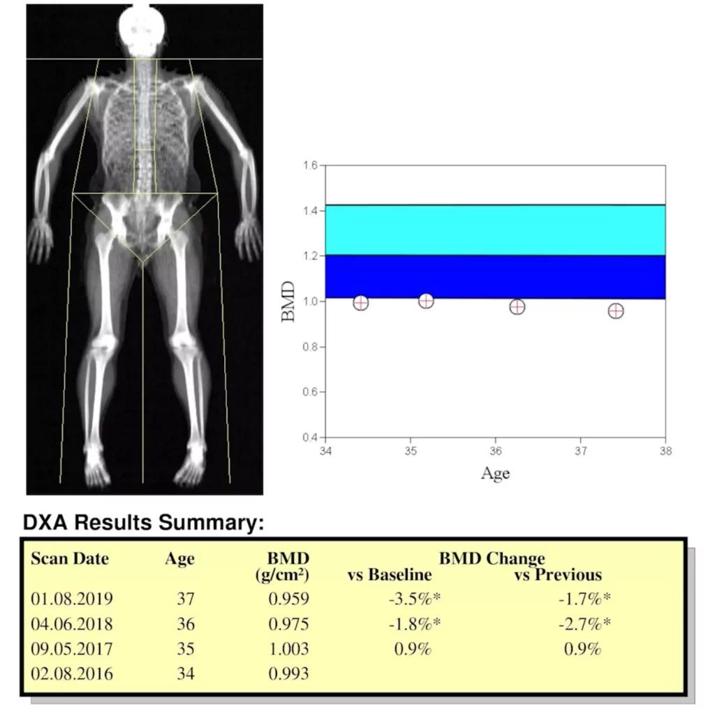 Decreasing-bone-density-DEXA-3-years