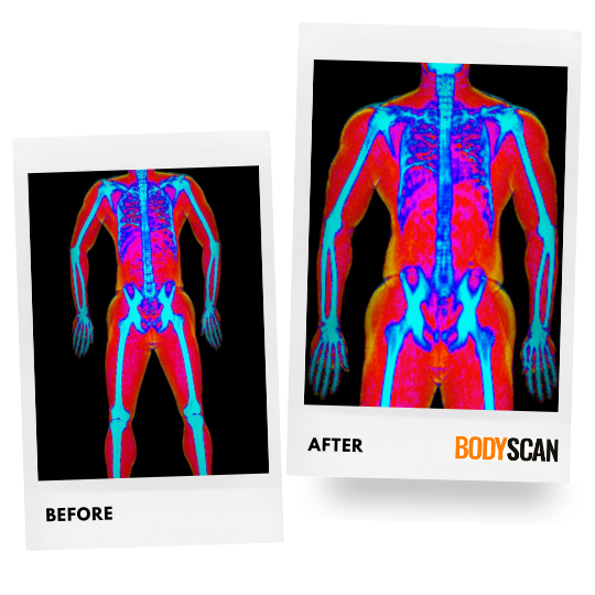 Nathan DEXA scans